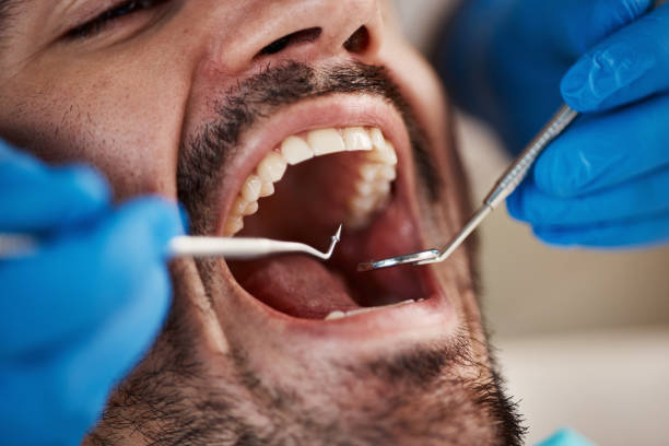 Best Emergency Dentist for Knocked-Out Tooth in Garner, NC